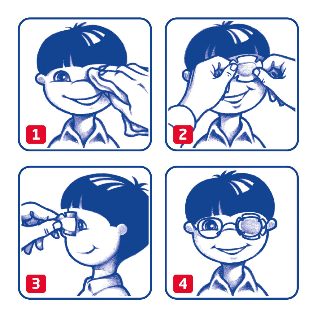 Eye Oclusor Junior 30 u.